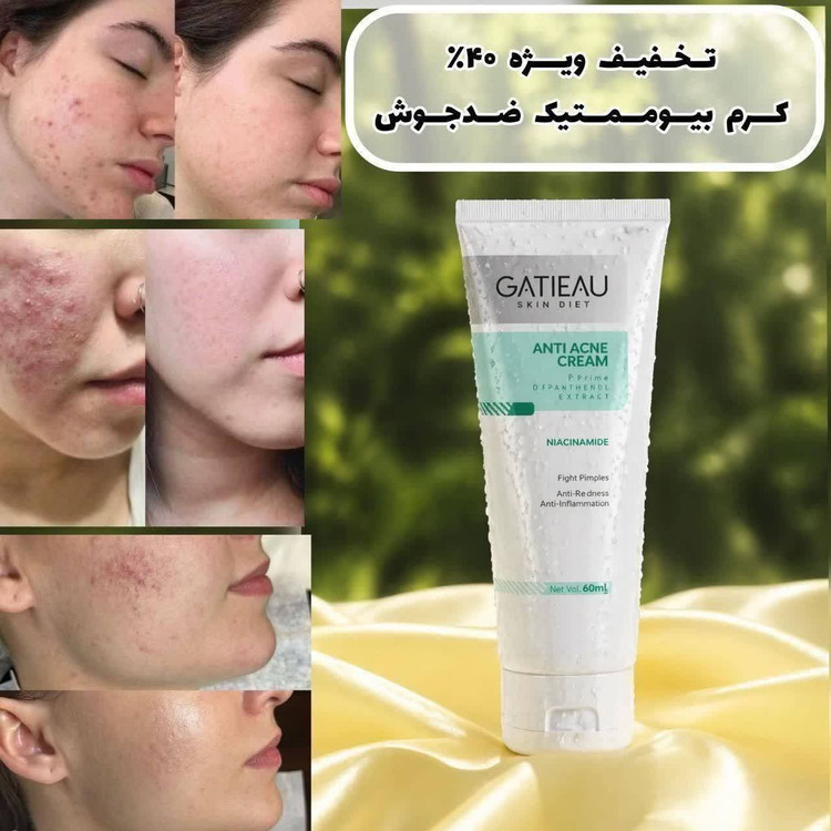 کرم گاتیو (GATIEAU)